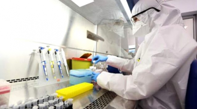 Koronavirüt test kitleri hatalı sonuç veriyor