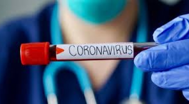 Koronavirüs tablosunda iyileşen, test yaptıran ve ağır hasta sayısı kaç?