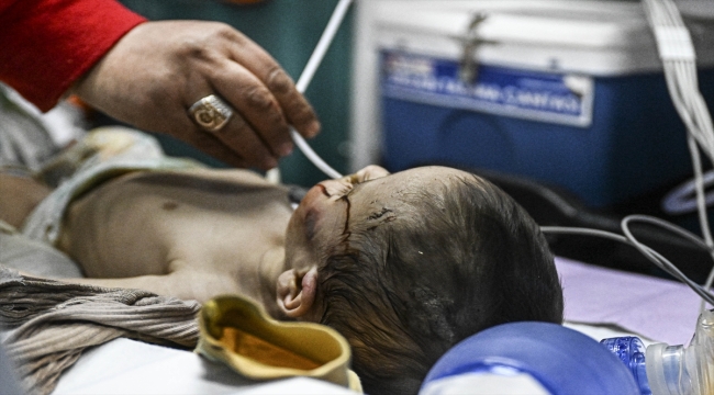Hatay'da enkaz altında kalan 7 aylık bebek, 140 saat sonra kurtarıldı