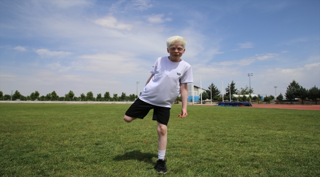 Türkiye şampiyonu albino çocuklar atletizmde uluslararası başarılara odaklandı